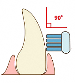 イラスト:歯ブラシの当て方