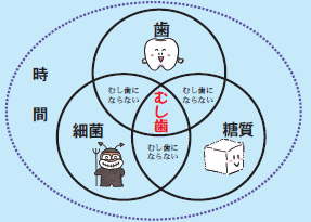 イラスト:むし歯の条件