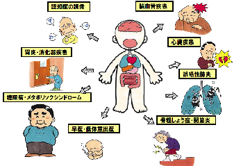イラスト:歯周病と全身疾患