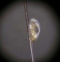 写真:髪の毛に産みつけられたアタマジラミの卵