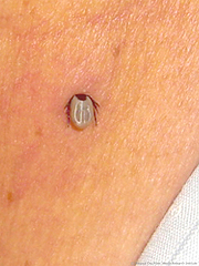 写真：吸血中のマダニ