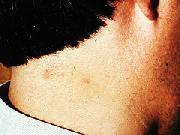 写真:シバンムシアリガタバチ被害例