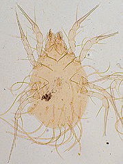 写真:イエニクダニ(プレパラート標本)