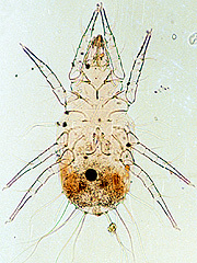 写真:ケナガコナダニ(プレパラート標本)
