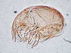 写真:ミジンイレコダニ2(プレパラート標本)