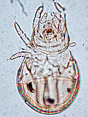 写真:ミジンイレコダニ1(プレパラート標本)