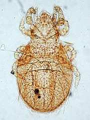 写真:カザリヒワダニ(プレパラート標本)