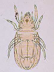 写真:イエササラダニ(プレパラート標本)