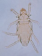 写真:シラミダニ(プレパラート標本)