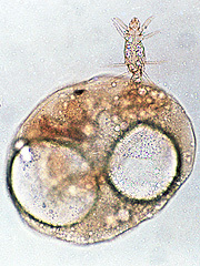 写真:シラミダニ(雌,プレパラート標本,胴の後部に2つ見える白く大きい円形の物は気泡)