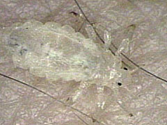 写真:コロモジラミ