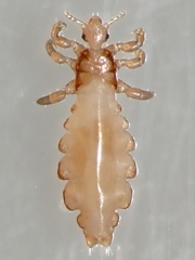 写真:アタマジラミ成虫