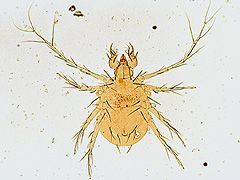 写真:アシナガツメダニ