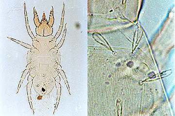 写真:ミナミツメダニ