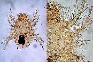写真:ツメダニの一種