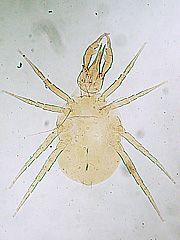 写真:オソイダニの一種(プレパラート標本)