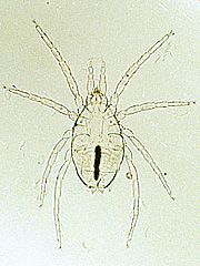 写真:イエハリクチグダニ(プレパラート標本)