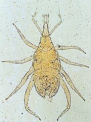 写真:イエハリテングダニ(プレパラート標本)