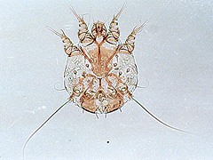 写真:ヒゼンダニ