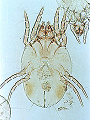 写真:コナヒョウヒダニ(雌,プレパラート標本)