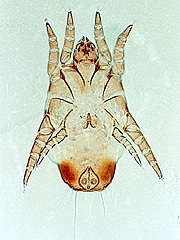 写真:ヤケヒョウヒダニ(雄,プレパラート標本)