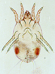 写真:ヤケヒョウヒダニ(雌,プレパラート標本)