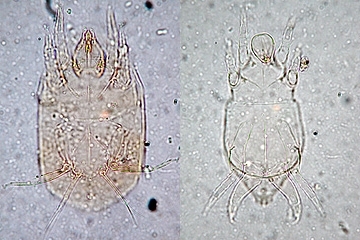 写真:ホコリダニの一種(プレパラート標本,左:雌,右:雄)