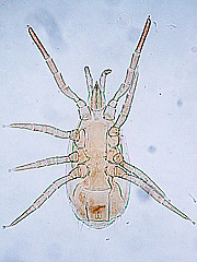 写真:タンカンマヨイダニ(プレパラート標本)