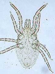 写真:スズメサシダニ(プレパラート標本)