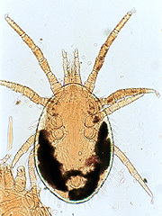 写真:イエダニ(プレパラート標本)