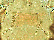 写真:イエダニ胸板(プレパラート標本)