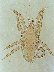 写真:トリサシダニ(プレパラート標本)