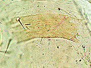 写真:トリサシダニ胸板(プレパラート標本)