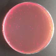 大腸菌群を培養した培地の写真