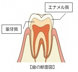イラスト：歯の断面図