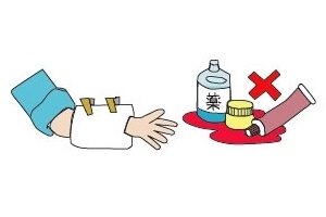 火傷の手当てのイラスト02