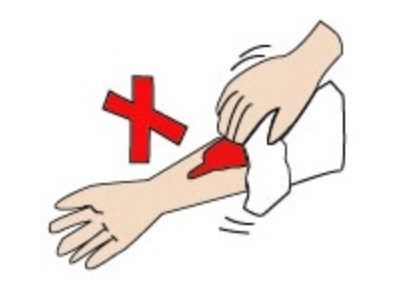 火傷の手当てのイラスト03