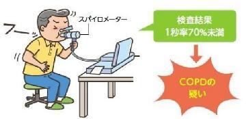 イラスト：スパイロメーターを使って、限界まで息を吸って、できるだけ速く一気に吐き出したときの空気量(努力肺活量)の内、初めの1秒間に吐き出された空気量(1秒量)を努力肺活量で割り算したパーセンテージの値が70パーセント未満であればCOPDが疑われます。