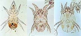 無気門亜目ダニ類(左からケナガコナダニ、コナヒョウヒダニ雄、コナヒョウヒダニ雌)