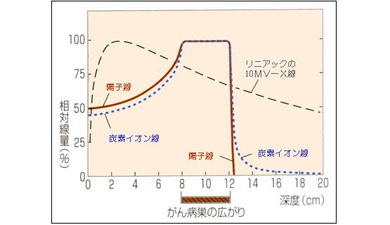 身体表面からの深度と相対線量の相関関係を示す図例。粒子線は任意の深さで線量をピークにできるため、がん病巣にピンポイントで照射ができます。